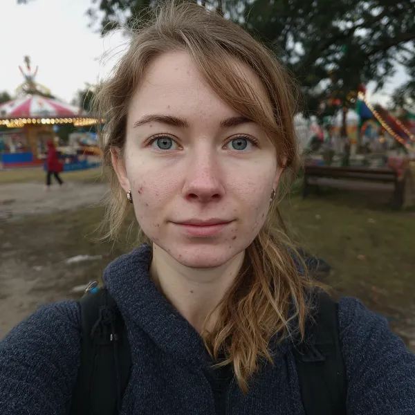before photo of remove acne from photos